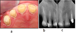 Journal-Dental-Craniofacial-Research-Fiber