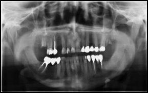 Journal-Dental-Craniofacial-Research-Radiograph