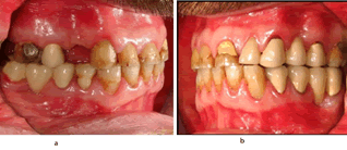 Journal-Dental-Craniofacial-Research-Right