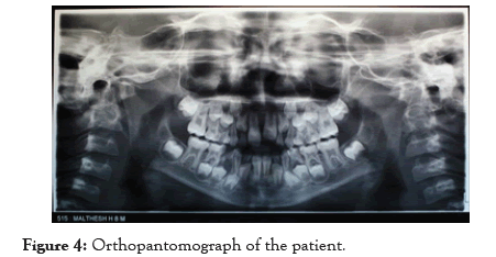 global-research-orthopantomograph