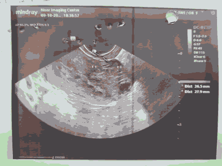 obste-gynec-ultrasound