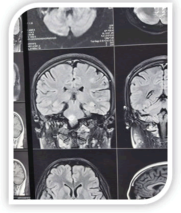 journal-neurology