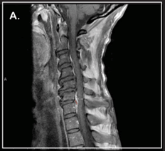 medical-case-spine