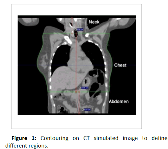 medical-physics-contouring