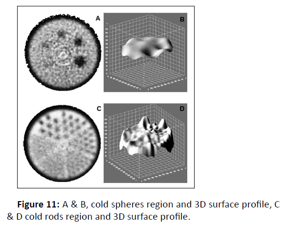 medical-physics-spheres