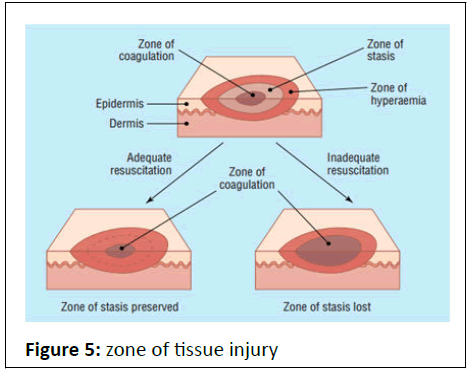 pediatric-care-injury