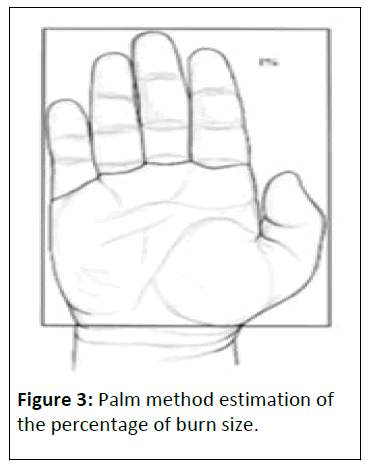 pediatric-care-palm-method