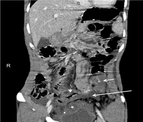 trauma-acute-contrast