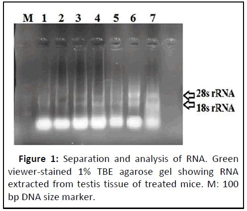 IPJREI-RNA