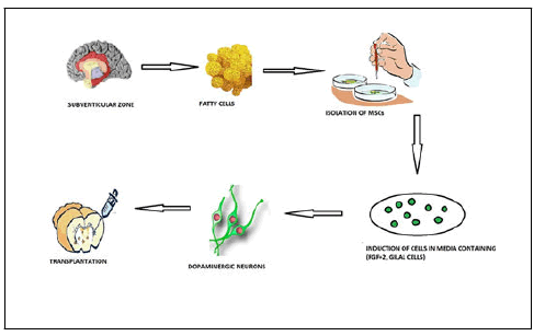 IPNBT-Diagram