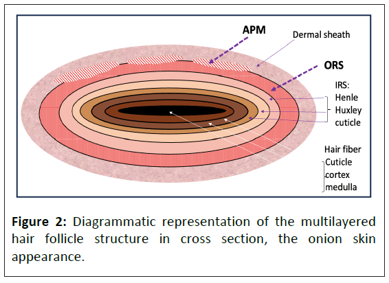 american-journal-diagrammatic