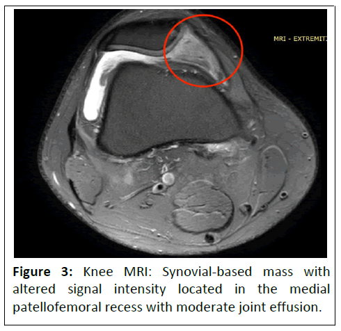 clinical-experimental-patellofemoral
