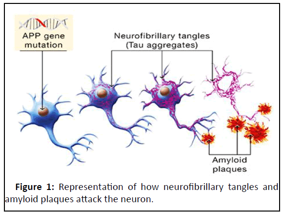 ipjnp-tangles