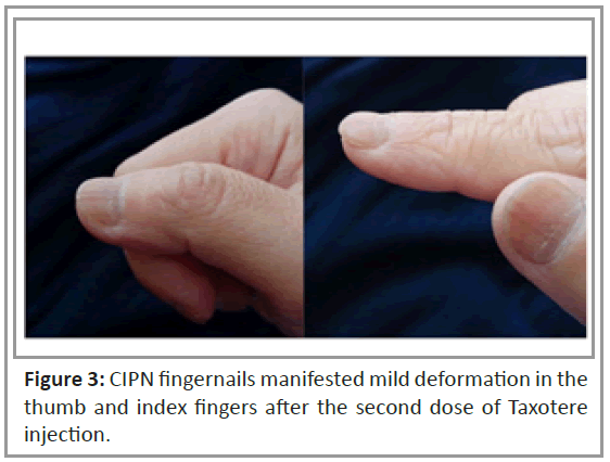 medical-case-fingernails