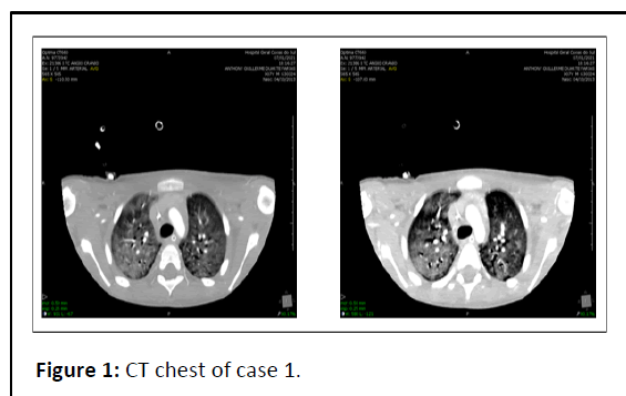 pediatric-infectious-chest