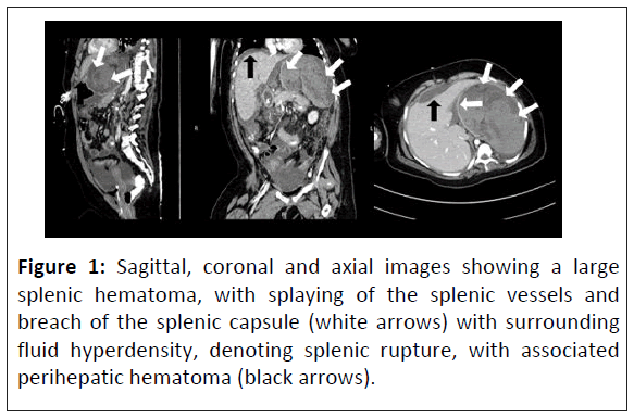 rare-disorders-axial-images