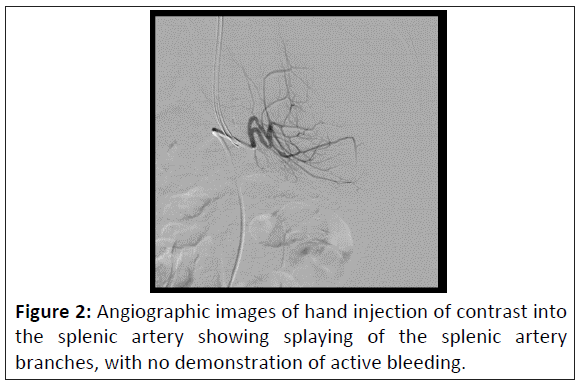 rare-disorders-hand-injection