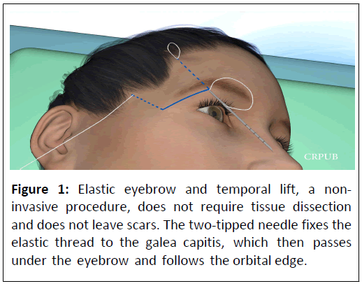 aesthetic-elastic-eyebrow