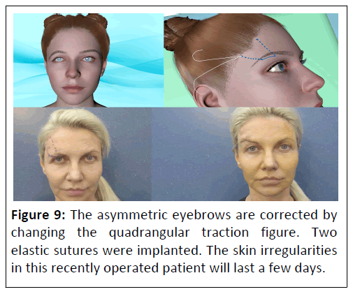 aesthetic-quadrangular