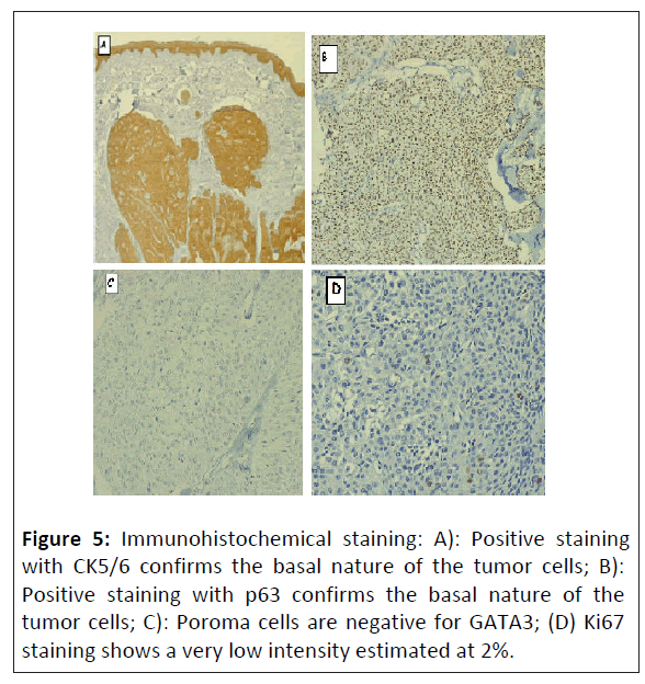 critical-care-Immunohistochemical