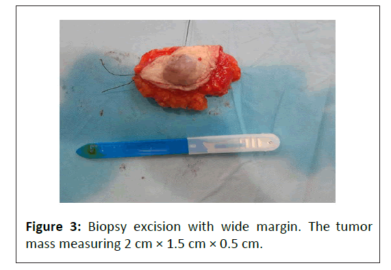 critical-care-wide-margin