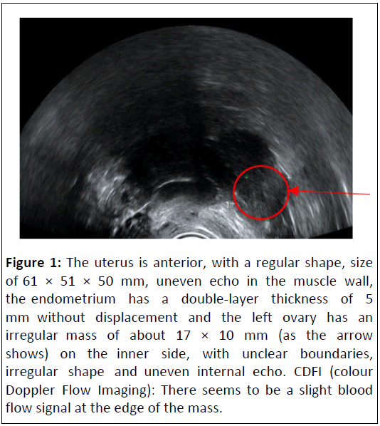 medical-case-endometrium