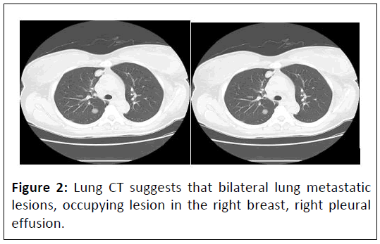 medical-case-metastatic