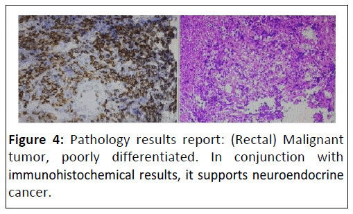 medical-case-neuroendocrine