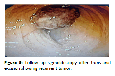 medical-case-recurrent-tumor