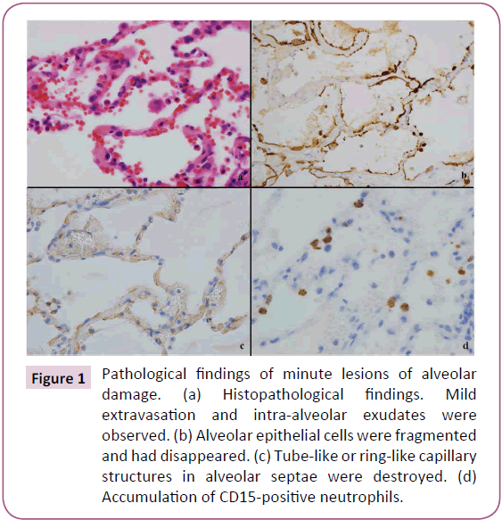 chronic-obstructive-pulmonary-disease-minute-lesions