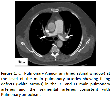 clinical-radiology-Pulmonary