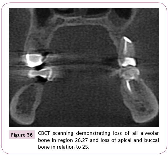 dental-craniofacial-research-CBCT-scanning