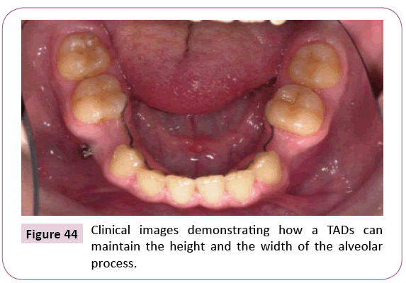 dental-craniofacial-research-Clinical-images