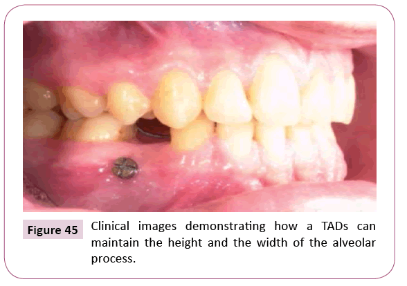 dental-craniofacial-research-Clinical-images