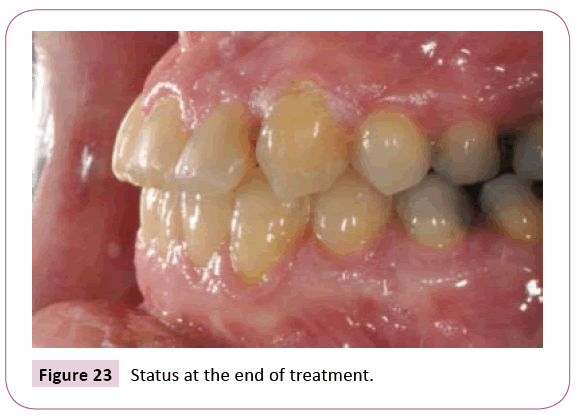 dental-craniofacial-research-end-treatment