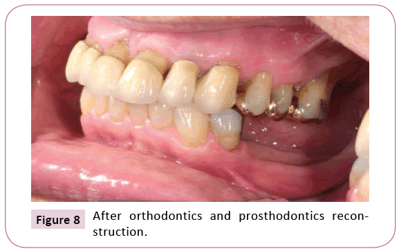 dental-craniofacial-research-orthodontics-prosthodontics