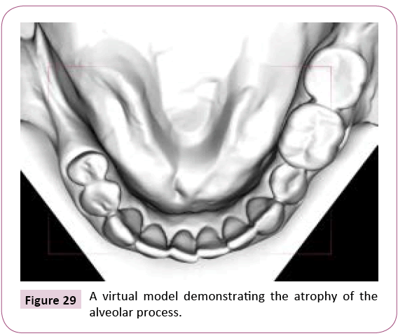 dental-craniofacial-research-virtual-model